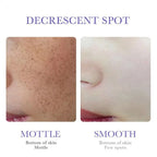 SADOER Freckle Removing Cream Nicotinamide Face Cream for Faical Moisturizing Nourishing Hydrating Firming Spot Facial Creams