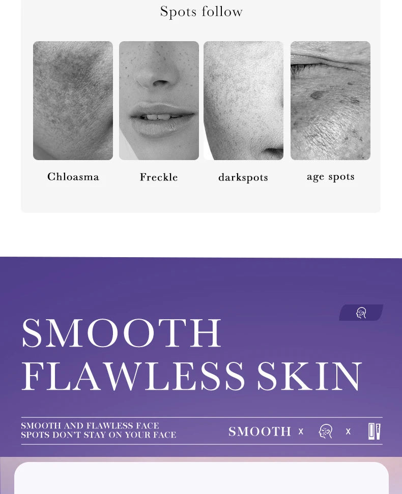 SADOER Freckle Removing Cream Nicotinamide Face Cream for Faical Moisturizing Nourishing Hydrating Firming Spot Facial Creams