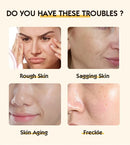 20% Vitamin C Ampoule Serum Set  Moisturising Whitening Wrinkle Reducing Anti-Ageing Serum Face Beauty Skin Care