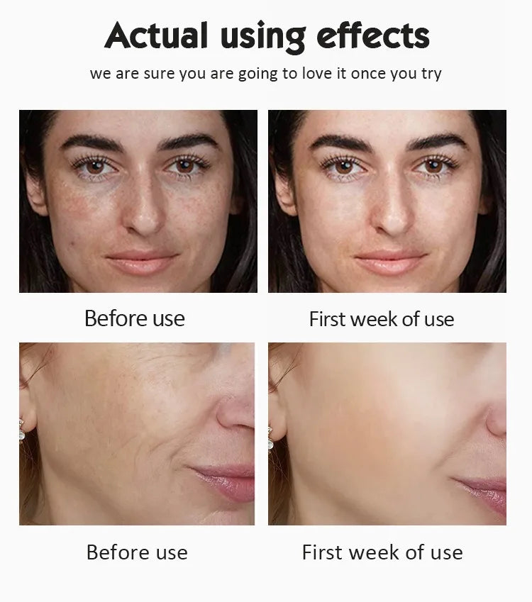 20% Vitamin C Ampoule Serum Set  Moisturising Whitening Wrinkle Reducing Anti-Ageing Serum Face Beauty Skin Care